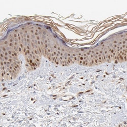 Invitrogen Survivin Polyclonal Antibody 100 μL; Unconjugated:Antibodies,