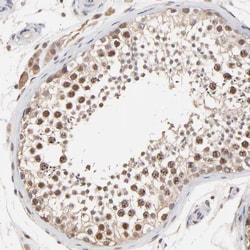 Invitrogen Survivin Polyclonal Antibody 100 μL; Unconjugated:Antibodies,