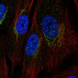 Invitrogen COX1 Polyclonal Antibody 100 &mu;L; Unconjugated:Antibodies,