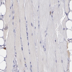 Invitrogen COX1 Polyclonal Antibody 100 &mu;L; Unconjugated:Antibodies,