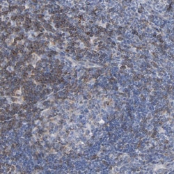 Invitrogen SKAP55 Polyclonal Antibody 100 &mu;L; Unconjugated:Antibodies,