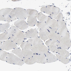 Invitrogen SKAP55 Polyclonal Antibody 100 &mu;L; Unconjugated:Antibodies,