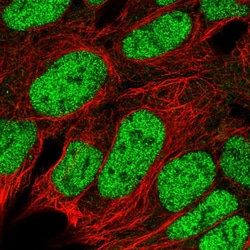 Invitrogen ROC1 Polyclonal Antibody 100 μL; Unconjugated:Antibodies,