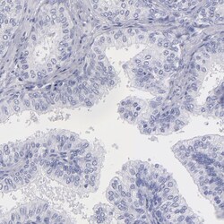 Invitrogen Myoglobin Polyclonal Antibody 100 &mu;L; Unconjugated:Antibodies,