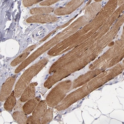 Invitrogen Myoglobin Polyclonal Antibody 100 &mu;L; Unconjugated:Antibodies,