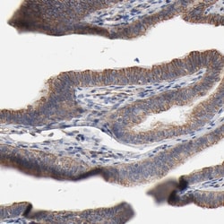 Invitrogen ABCD4 Polyclonal Antibody 100 &mu;L; Unconjugated:Antibodies,