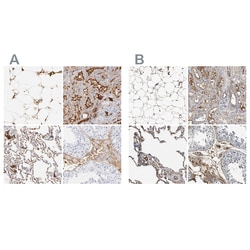 Invitrogen Complement C3 Polyclonal Antibody:Antibodies:Primary Antibodies