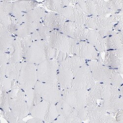 P2Y8 Polyclonal Antibody:Antibodies, Polyclonal