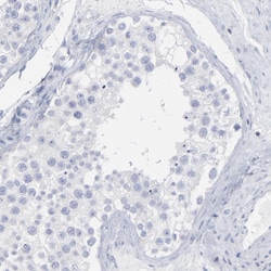 P2Y8 Polyclonal Antibody:Antibodies, Polyclonal