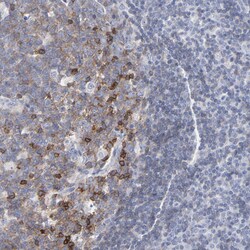 P2Y8 Polyclonal Antibody:Antibodies, Polyclonal