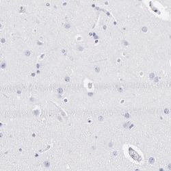 Invitrogen CD180 Polyclonal Antibody 100 &mu;L; Unconjugated:Antibodies,