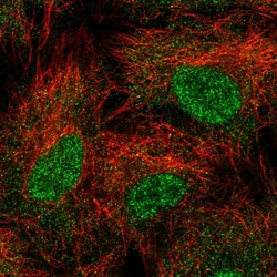 Invitrogen UBE2B Polyclonal Antibody 100 &mu;L; Unconjugated:Antibodies,