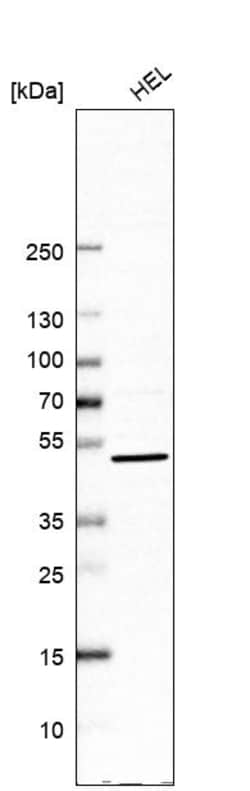 Invitrogen UBP1 Polyclonal Antibody 100 &mu;L; Unconjugated:Antibodies,