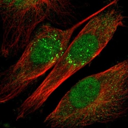 Invitrogen IL-18 Polyclonal Antibody 100 μL; Unconjugated:Antibodies,