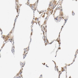 Invitrogen IL-18 Polyclonal Antibody 100 μL; Unconjugated:Antibodies,