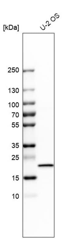 Invitrogen IL-18 Polyclonal Antibody 100 &mu;L; Unconjugated:Antibodies,