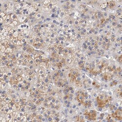 Invitrogen SEMA5A Polyclonal Antibody 100 &mu;L; Unconjugated:Antibodies,