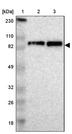 Invitrogen KIF2A Polyclonal Antibody 100 &mu;L; Unconjugated:Antibodies,