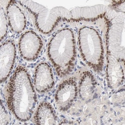 Invitrogen Fra2 Polyclonal Antibody:Antibodies:Primary Antibodies