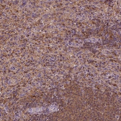 Invitrogen MATK Polyclonal Antibody 100 μL; Unconjugated:Antibodies,