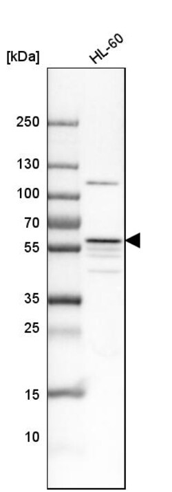 Invitrogen MATK Polyclonal Antibody 100 &mu;L; Unconjugated:Antibodies,