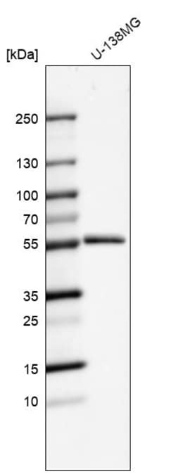 Invitrogen MMP1 Polyclonal Antibody 100 &mu;L; Unconjugated:Antibodies,