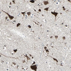 Invitrogen AATF Polyclonal Antibody 100 &mu;L; Unconjugated:Antibodies,