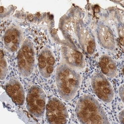 Invitrogen Renin Polyclonal Antibody 100 μL; Unconjugated:Antibodies,