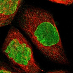 Invitrogen BRIP1 Polyclonal Antibody 100 &mu;L; Unconjugated:Antibodies,