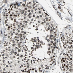 Invitrogen BRIP1 Polyclonal Antibody 100 &mu;L; Unconjugated:Antibodies,