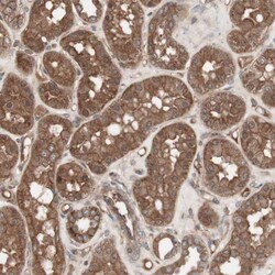 Invitrogen TFPI Polyclonal Antibody 100 &mu;L | Buy Online | Invitrogen&trade; | Fisher Scientific