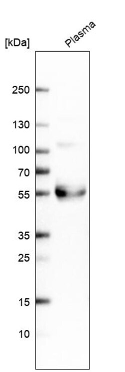 Invitrogen TFPI Polyclonal Antibody 100 &mu;L | Buy Online | Invitrogen&trade; | Fisher Scientific