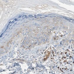 Invitrogen PEDF Polyclonal Antibody 100 &mu;L; Unconjugated:Antibodies,