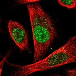 CDC25A Polyclonal Antibody, Invitrogen 100 μL; Unconjugated:Antibodies,
