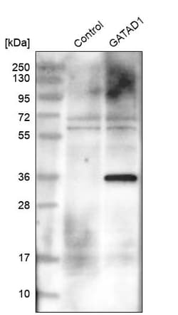 Invitrogen GATAD1 Polyclonal Antibody 100 &mu;L | Buy Online | Invitrogen&trade; | Fisher Scientific