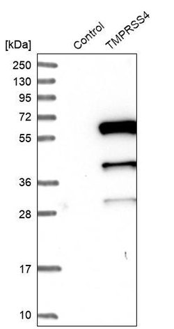 TMPRSS4 Rabbit anti-Human, Unconjugated, Polyclonal, Invitrogen 100 &mu;L;