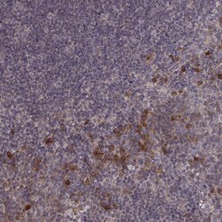 Invitrogen USP15 Polyclonal Antibody 100 &mu;L; Unconjugated:Antibodies,