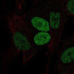 Invitrogen PRRX2 Polyclonal Antibody 100 &mu;L; Unconjugated:Antibodies,