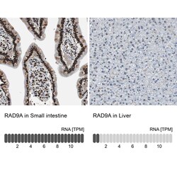 Invitrogen RAD9 Polyclonal Antibody 100 &mu;L | Buy Online | Invitrogen&trade; | Fisher Scientific