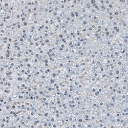 Invitrogen RAD9 Polyclonal Antibody 100 &mu;L | Buy Online | Invitrogen&trade; | Fisher Scientific