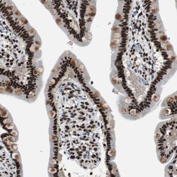 Invitrogen RAD9 Polyclonal Antibody 100 &mu;L | Buy Online | Invitrogen&trade; | Fisher Scientific