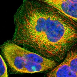 Invitrogen USP2 Polyclonal Antibody 100 &mu;L; Unconjugated:Antibodies,