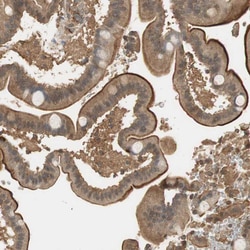 Invitrogen USP2 Polyclonal Antibody 100 &mu;L; Unconjugated:Antibodies,