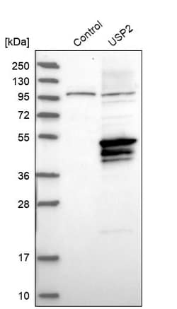 Invitrogen USP2 Polyclonal Antibody 100 &mu;L | Buy Online | Invitrogen&trade; | Fisher Scientific