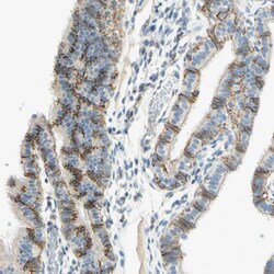Invitrogen K-cadherin Polyclonal Antibody 100 &mu;L | Buy Online | Invitrogen&trade; | Fisher Scientific