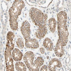 Invitrogen K-cadherin Polyclonal Antibody 100 &mu;L | Buy Online | Invitrogen&trade; | Fisher Scientific