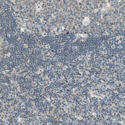 Invitrogen K-cadherin Polyclonal Antibody 100 &mu;L | Buy Online | Invitrogen&trade; | Fisher Scientific