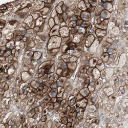 Invitrogen ALPL Polyclonal Antibody 100 μL; Unconjugated:Antibodies,