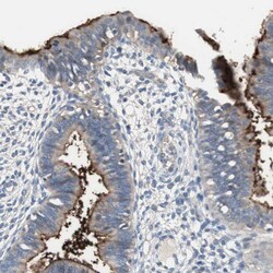 Invitrogen ALPL Polyclonal Antibody 100 μL; Unconjugated:Antibodies,
