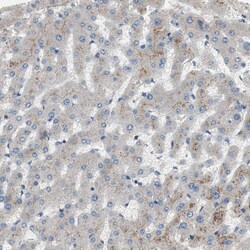 Invitrogen ALPL Polyclonal Antibody 100 μL; Unconjugated:Antibodies,